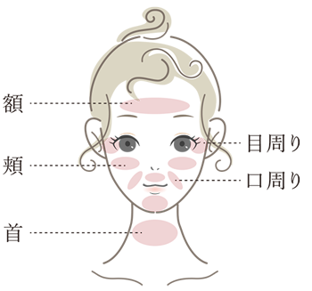 ジャルプロで施術可能な部位