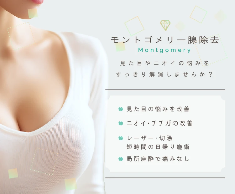 モントゴメリー腺除去