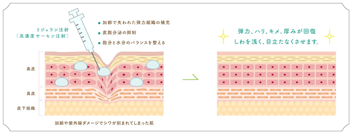 肌の修復と再生の促進