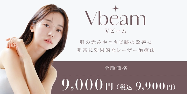 Vビーム