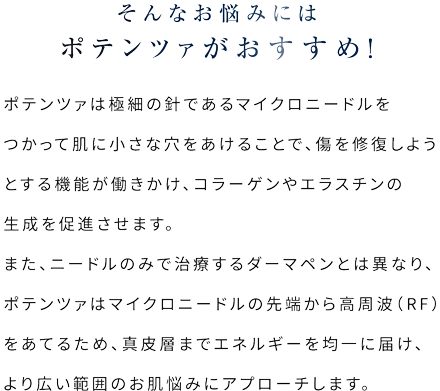 そんなお悩みにはポテンツァがおすすめ！