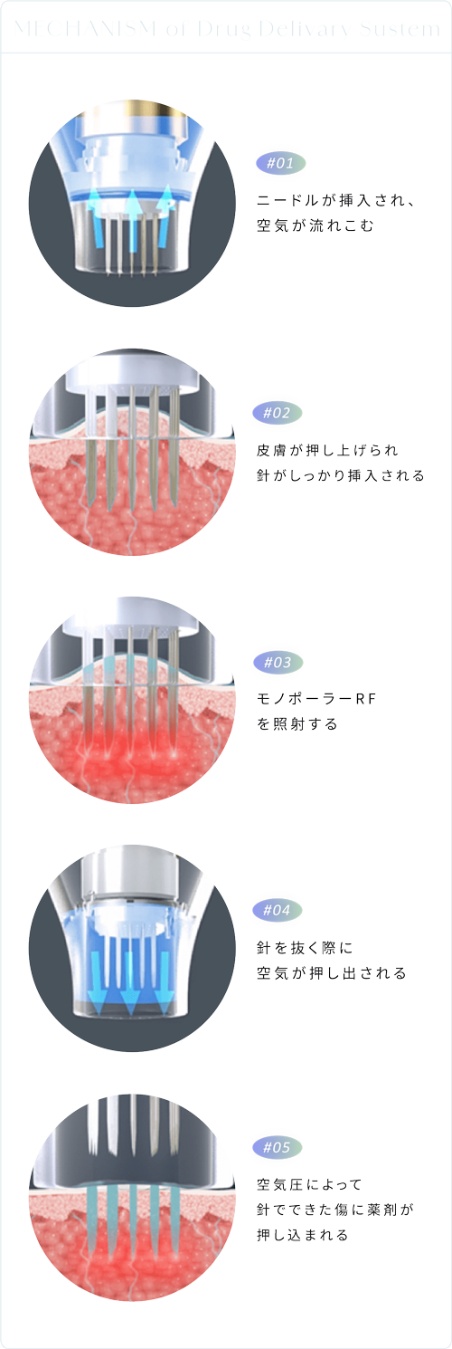 ポテンツァの仕組み